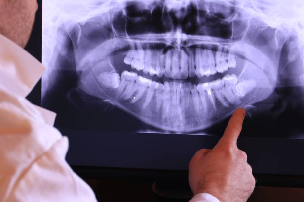 Best Emergency Gum Treatment in Carlisle, KY
